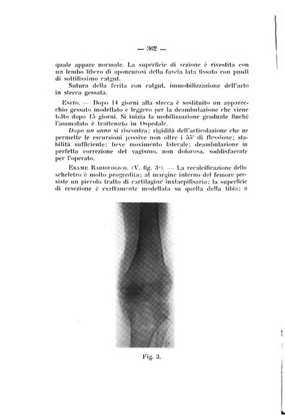 Archivio di ortopedia pubblicazione ufficiale del Pio istituto dei rachitici <1924-1950>