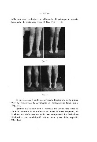 Archivio di ortopedia pubblicazione ufficiale del Pio istituto dei rachitici <1924-1950>