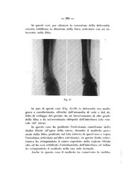 Archivio di ortopedia pubblicazione ufficiale del Pio istituto dei rachitici <1924-1950>