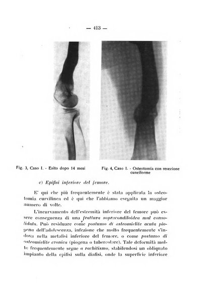 Archivio di ortopedia pubblicazione ufficiale del Pio istituto dei rachitici <1924-1950>