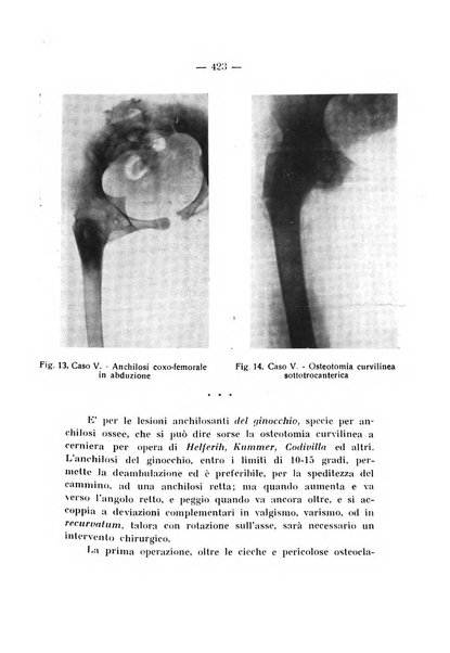 Archivio di ortopedia pubblicazione ufficiale del Pio istituto dei rachitici <1924-1950>