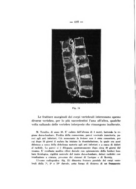 Archivio di ortopedia pubblicazione ufficiale del Pio istituto dei rachitici <1924-1950>