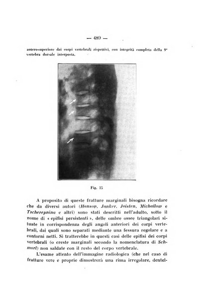 Archivio di ortopedia pubblicazione ufficiale del Pio istituto dei rachitici <1924-1950>