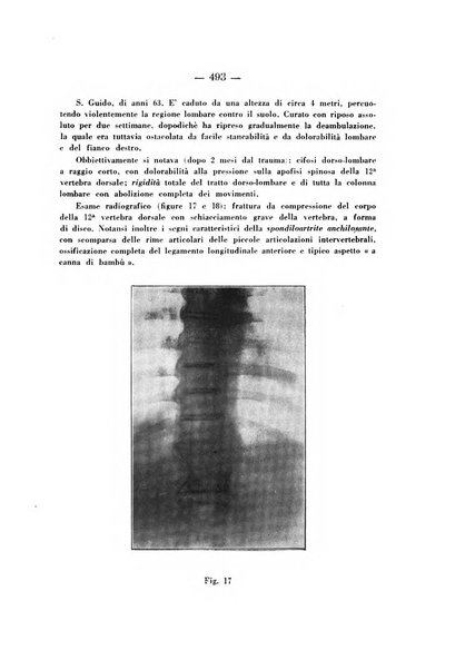 Archivio di ortopedia pubblicazione ufficiale del Pio istituto dei rachitici <1924-1950>