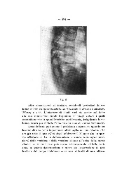 Archivio di ortopedia pubblicazione ufficiale del Pio istituto dei rachitici <1924-1950>