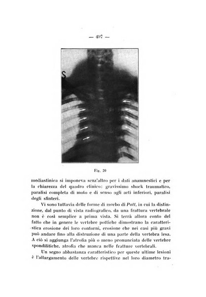 Archivio di ortopedia pubblicazione ufficiale del Pio istituto dei rachitici <1924-1950>