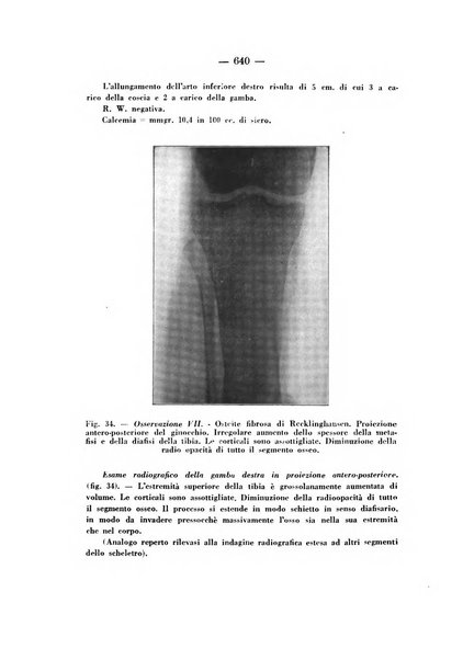 Archivio di ortopedia pubblicazione ufficiale del Pio istituto dei rachitici <1924-1950>