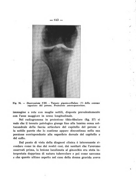 Archivio di ortopedia pubblicazione ufficiale del Pio istituto dei rachitici <1924-1950>