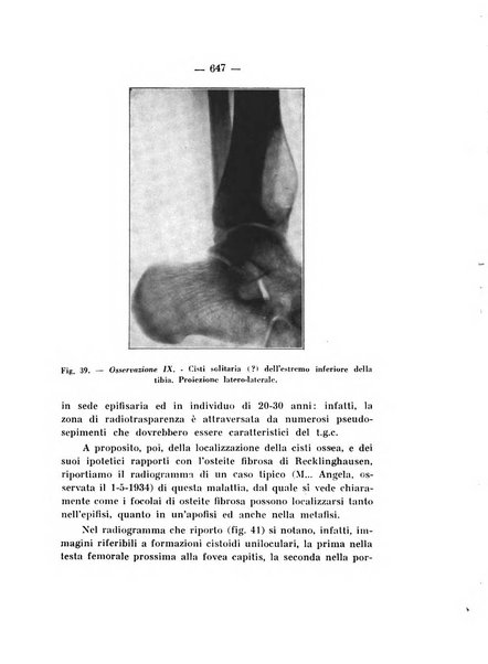 Archivio di ortopedia pubblicazione ufficiale del Pio istituto dei rachitici <1924-1950>