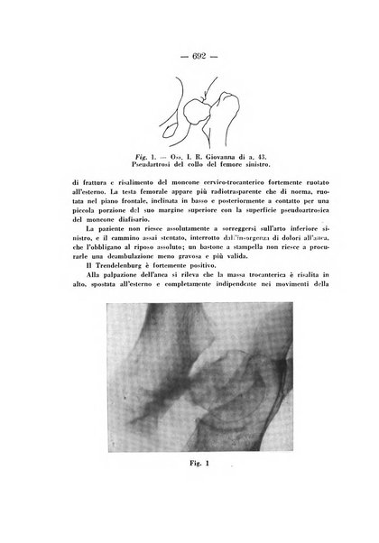 Archivio di ortopedia pubblicazione ufficiale del Pio istituto dei rachitici <1924-1950>