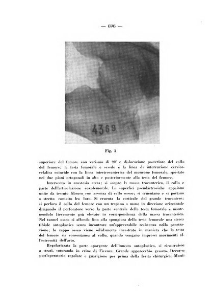 Archivio di ortopedia pubblicazione ufficiale del Pio istituto dei rachitici <1924-1950>