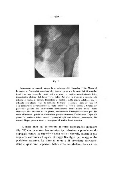 Archivio di ortopedia pubblicazione ufficiale del Pio istituto dei rachitici <1924-1950>