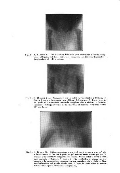 Archivio di ortopedia pubblicazione ufficiale del Pio istituto dei rachitici <1924-1950>