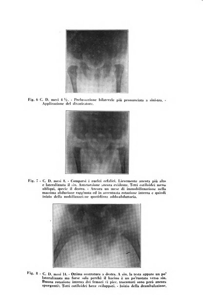 Archivio di ortopedia pubblicazione ufficiale del Pio istituto dei rachitici <1924-1950>