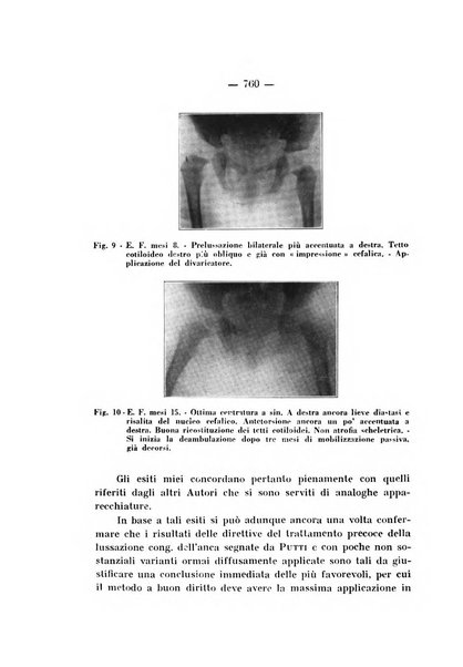 Archivio di ortopedia pubblicazione ufficiale del Pio istituto dei rachitici <1924-1950>