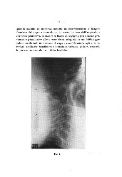 Archivio di ortopedia pubblicazione ufficiale del Pio istituto dei rachitici <1924-1950>