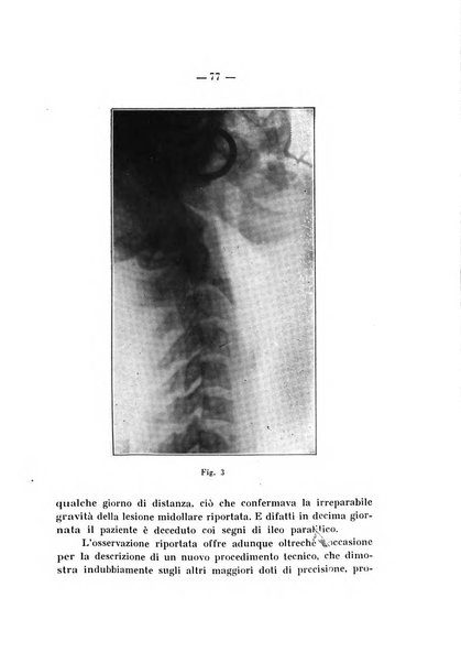 Archivio di ortopedia pubblicazione ufficiale del Pio istituto dei rachitici <1924-1950>