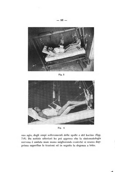 Archivio di ortopedia pubblicazione ufficiale del Pio istituto dei rachitici <1924-1950>