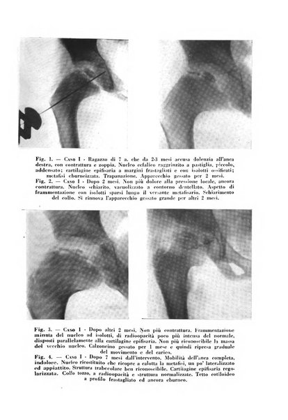 Archivio di ortopedia pubblicazione ufficiale del Pio istituto dei rachitici <1924-1950>