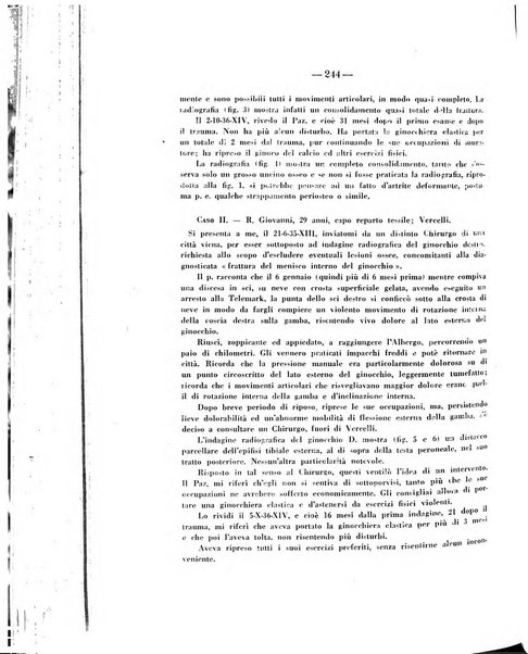 Archivio di ortopedia pubblicazione ufficiale del Pio istituto dei rachitici <1924-1950>