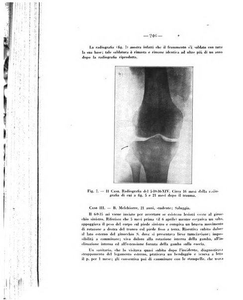 Archivio di ortopedia pubblicazione ufficiale del Pio istituto dei rachitici <1924-1950>