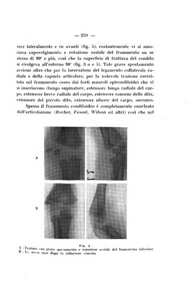 Archivio di ortopedia pubblicazione ufficiale del Pio istituto dei rachitici <1924-1950>