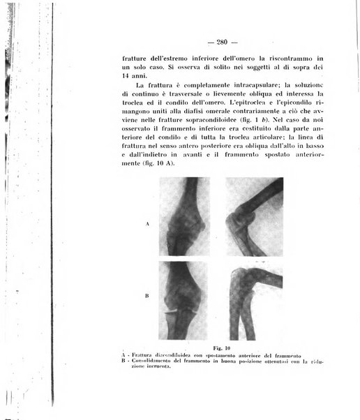 Archivio di ortopedia pubblicazione ufficiale del Pio istituto dei rachitici <1924-1950>