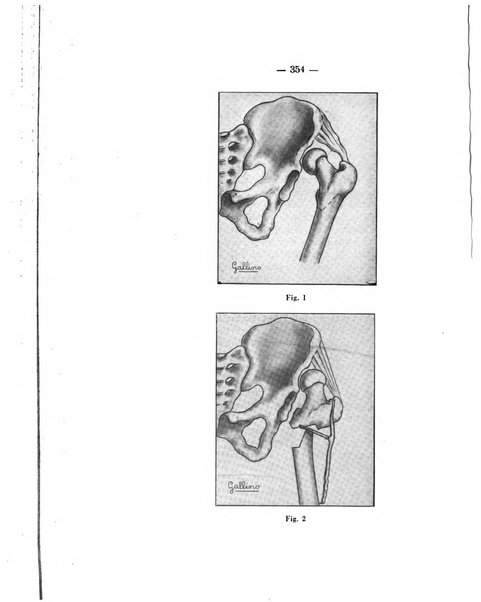 Archivio di ortopedia pubblicazione ufficiale del Pio istituto dei rachitici <1924-1950>