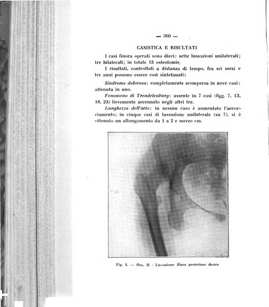 Archivio di ortopedia pubblicazione ufficiale del Pio istituto dei rachitici <1924-1950>