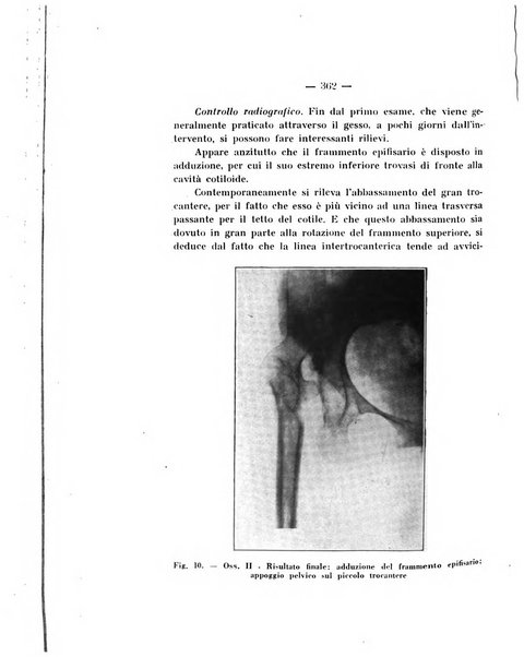 Archivio di ortopedia pubblicazione ufficiale del Pio istituto dei rachitici <1924-1950>