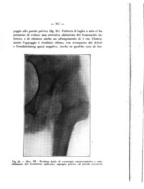 Archivio di ortopedia pubblicazione ufficiale del Pio istituto dei rachitici <1924-1950>