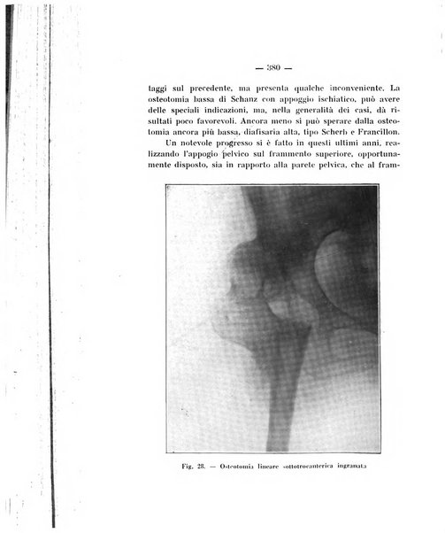 Archivio di ortopedia pubblicazione ufficiale del Pio istituto dei rachitici <1924-1950>