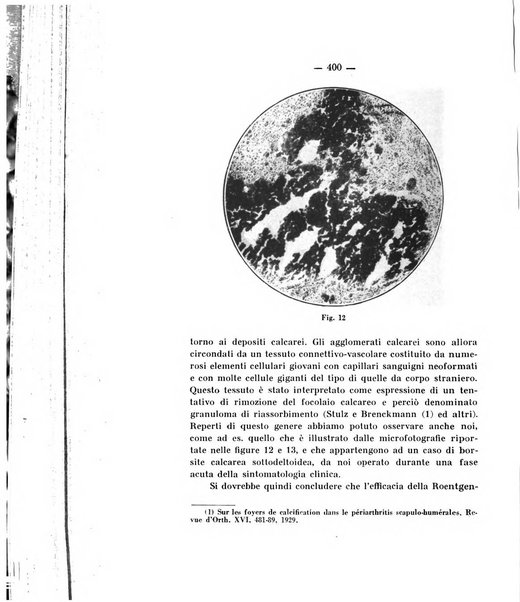 Archivio di ortopedia pubblicazione ufficiale del Pio istituto dei rachitici <1924-1950>