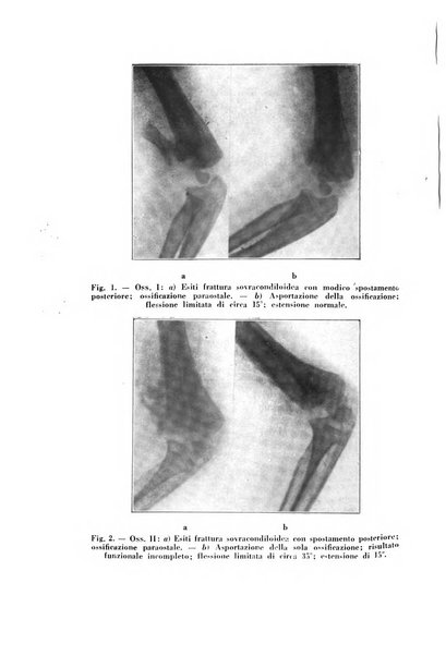 Archivio di ortopedia pubblicazione ufficiale del Pio istituto dei rachitici <1924-1950>