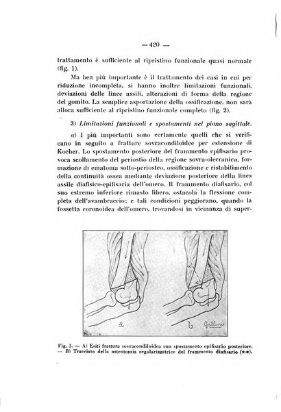 Archivio di ortopedia pubblicazione ufficiale del Pio istituto dei rachitici <1924-1950>