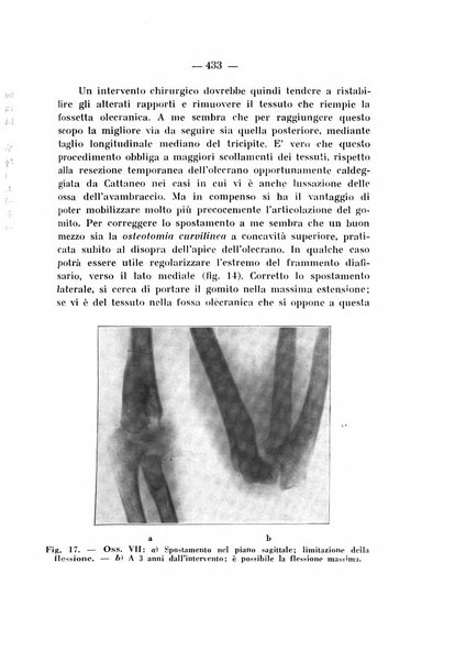 Archivio di ortopedia pubblicazione ufficiale del Pio istituto dei rachitici <1924-1950>