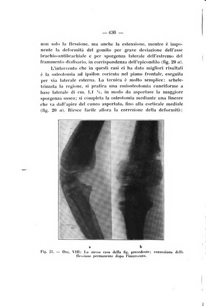 Archivio di ortopedia pubblicazione ufficiale del Pio istituto dei rachitici <1924-1950>