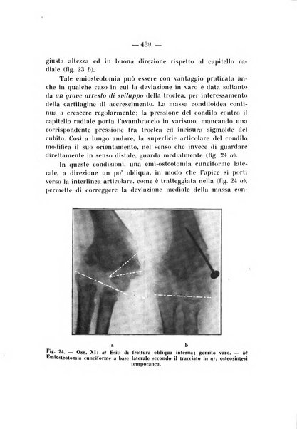 Archivio di ortopedia pubblicazione ufficiale del Pio istituto dei rachitici <1924-1950>