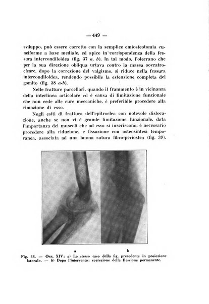 Archivio di ortopedia pubblicazione ufficiale del Pio istituto dei rachitici <1924-1950>