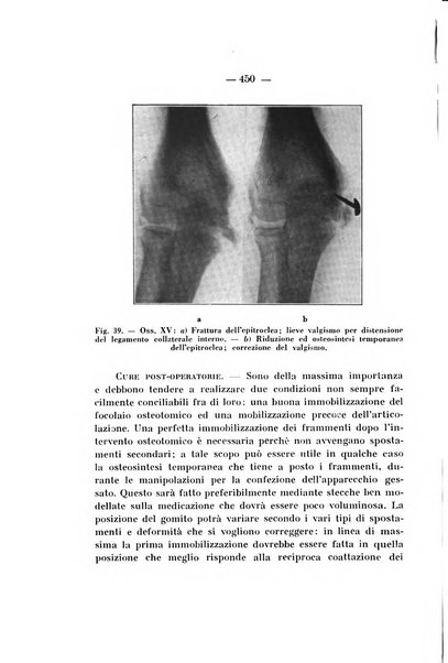 Archivio di ortopedia pubblicazione ufficiale del Pio istituto dei rachitici <1924-1950>