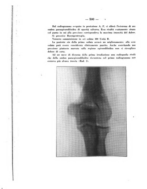 Archivio di ortopedia pubblicazione ufficiale del Pio istituto dei rachitici <1924-1950>