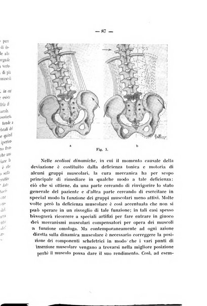 Archivio di ortopedia pubblicazione ufficiale del Pio istituto dei rachitici <1924-1950>