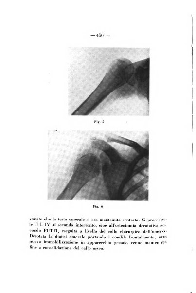 Archivio di ortopedia pubblicazione ufficiale del Pio istituto dei rachitici <1924-1950>