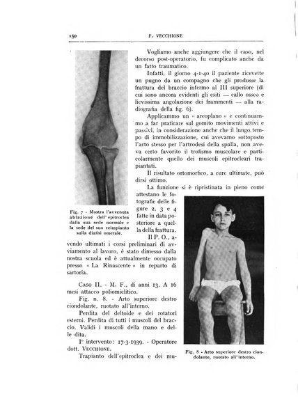 Archivio di ortopedia pubblicazione ufficiale del Pio istituto dei rachitici <1924-1950>