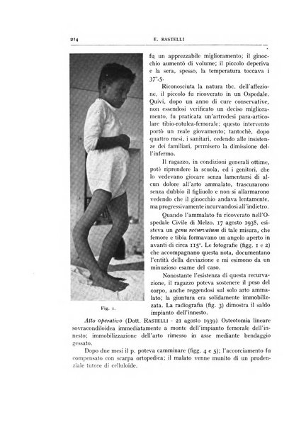 Archivio di ortopedia pubblicazione ufficiale del Pio istituto dei rachitici <1924-1950>