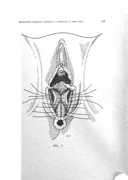 Archivio di ostetricia e ginecologia