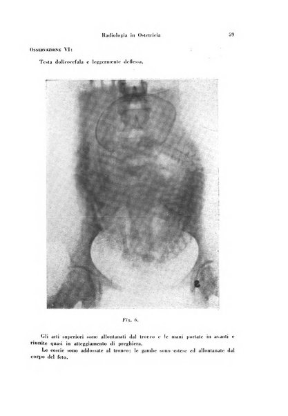 Archivio di ostetricia e ginecologia