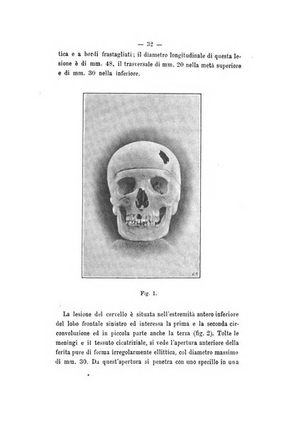 Archivio di psichiatria, scienze penali ed antropologia criminale per servire allo studio dell'uomo alienato e delinquente