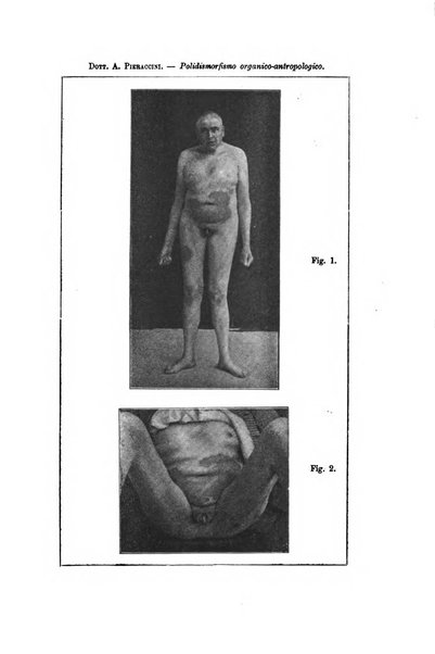 Archivio di psichiatria, scienze penali ed antropologia criminale per servire allo studio dell'uomo alienato e delinquente