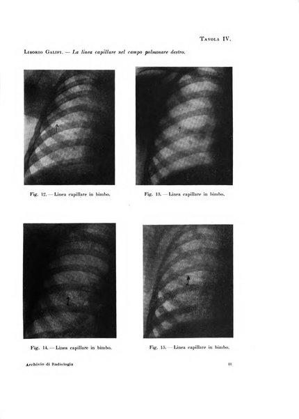 Archivio di radiologia